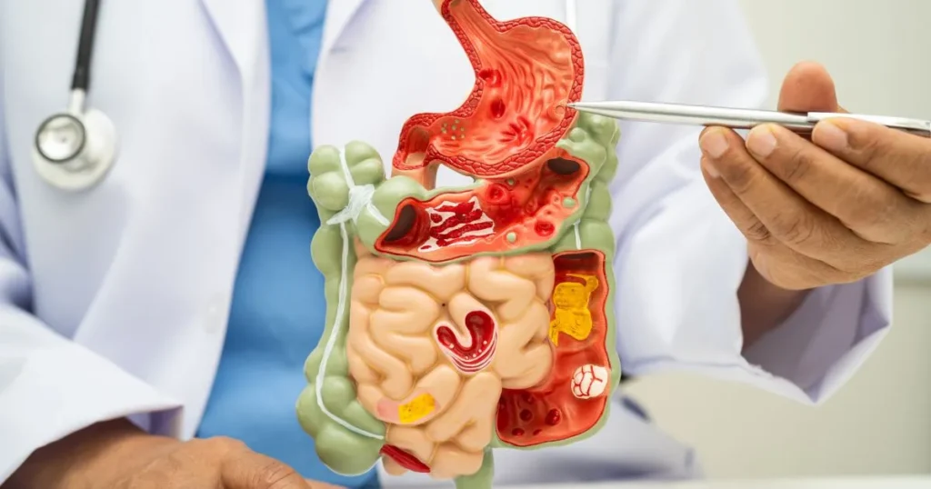 Médico explicando a un paciente los diferentes trastornos digestivos que puede sufrir.